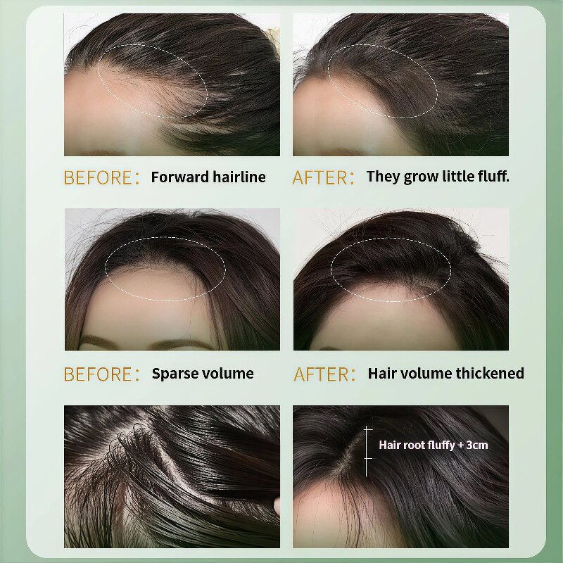 Platycladus Hair Shampoo Soap - Nature Green Triangle Oil Control Anti-Dandruff