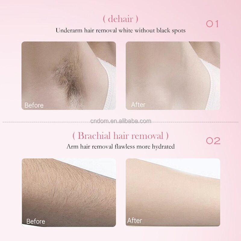 Hair Removal Cream - Private Label OEM ODM Permanent Depilatory Sensitive Skin