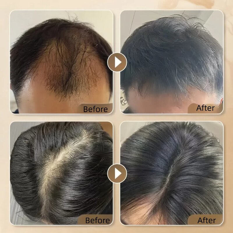 Neo Hair Growth Oil - Bulk Private Label Best Organic Regrowth Serum