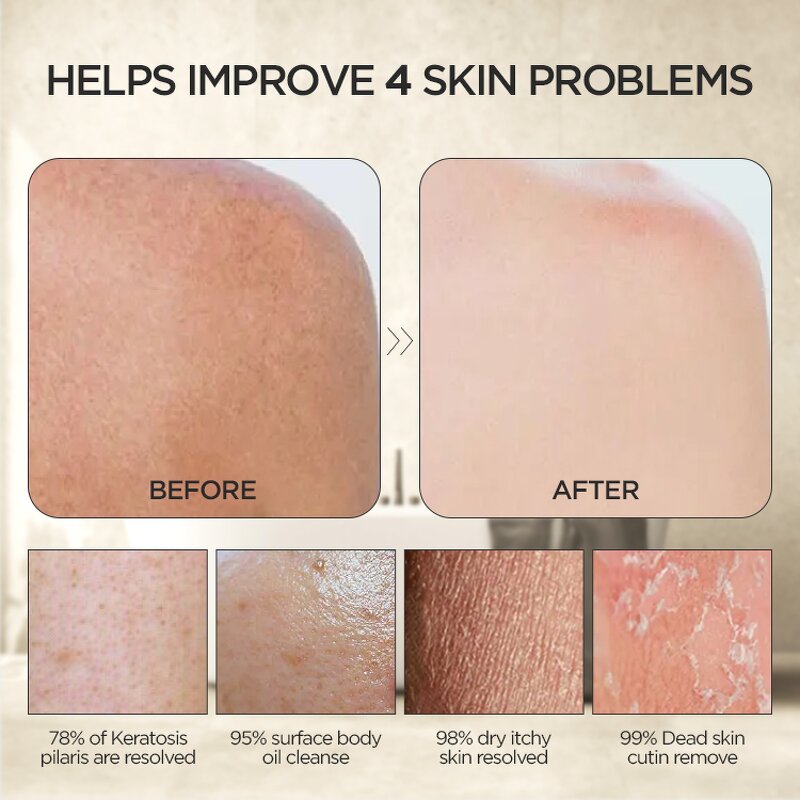 African Net Bath Sponge - Exfoliating Washcloth Towel Back Scrubber Tool