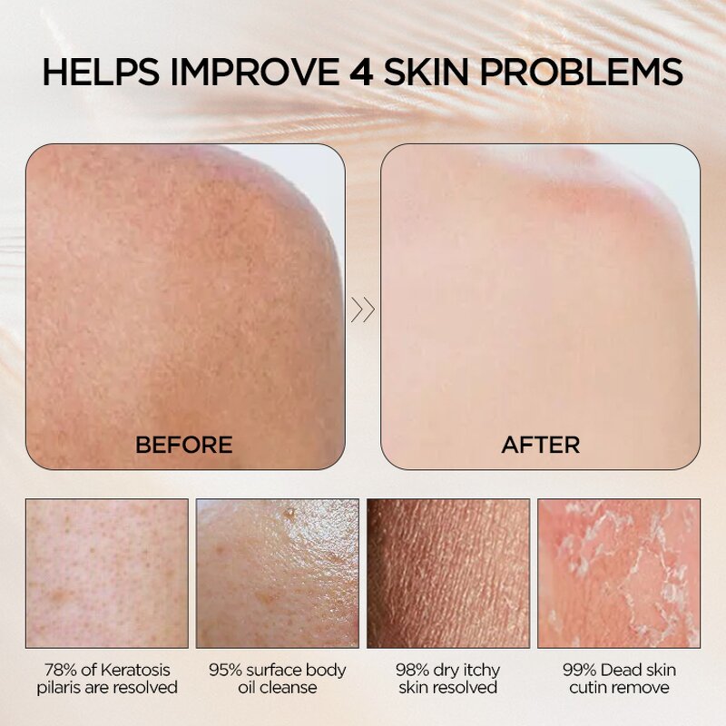 Viscose Exfoliating Mitt - High Quality Custom LOGO Soft Shower Scrub Glove