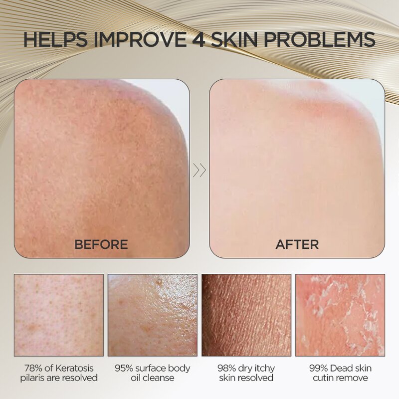 Body Scrubbing Brush - Factory Price Wholesale Back Scrubber Towel Tool