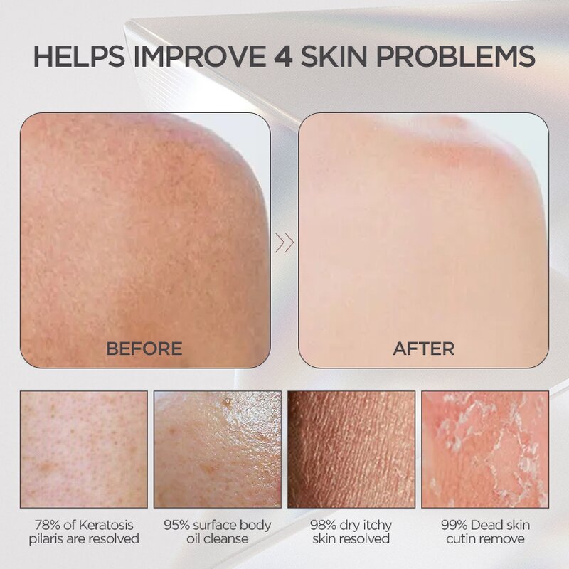 Kessa Exfoliating Mitt - Natural Fiber Moroccan Turkish Scrub for Men Women