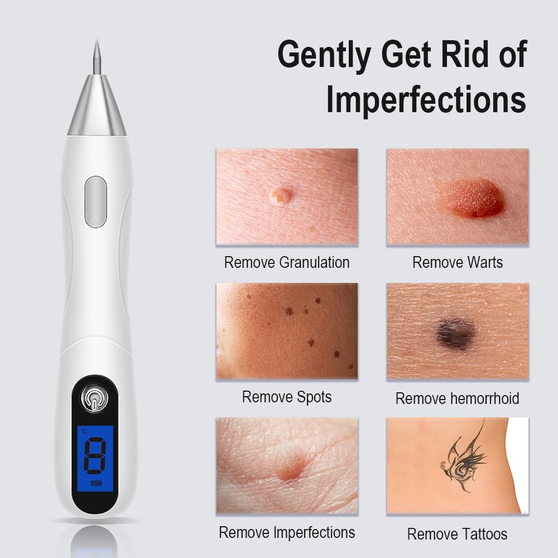 Mole Remover Pen Manufacturer - Factory Wholesale Blue Spotlight Skin Tag