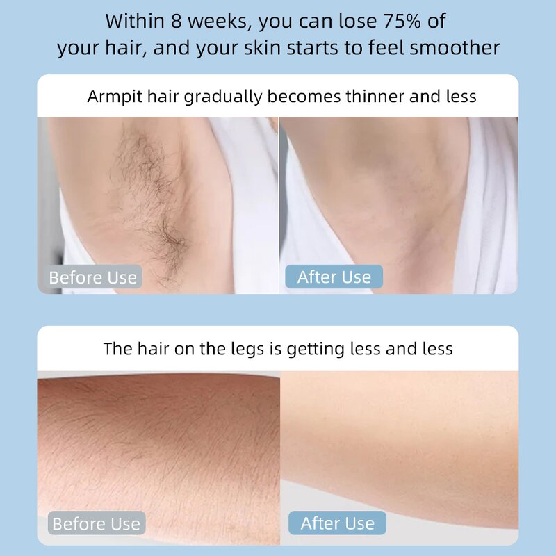 IPL Hair Remover Manufacturer - Wholesale Quartz Lamp Ice Cooling Portable