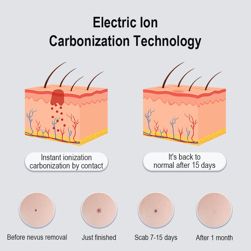 Mole Removal Pen Manufacturer - 2024 Electric LCD Display Beauty