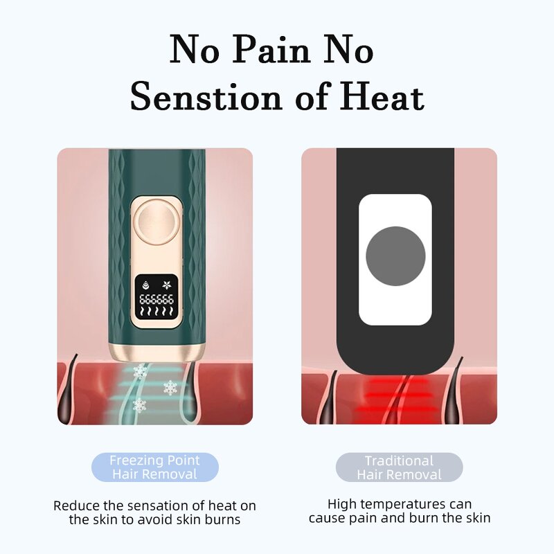 IPL Hair Removal Manufacturer - Painless with Heating/Cooling Treatment