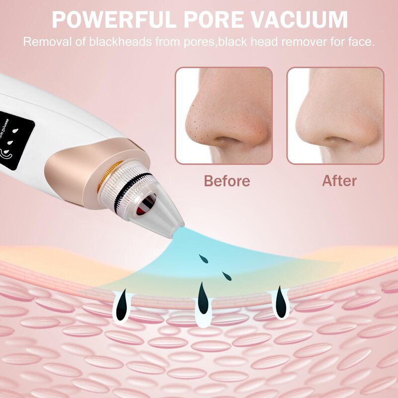 Pore Vacuum Manufacturer - Electric Blackhead Remover for Acne with 5 Suction Heads