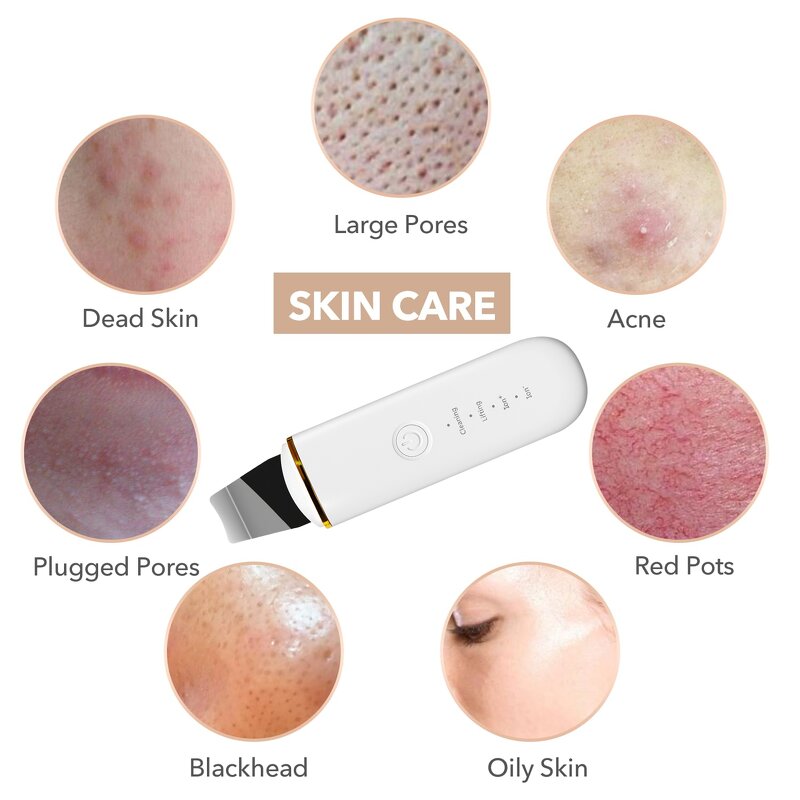 Electric Face Spatula Manufacturer - Pore Cleaner and Skin Scrubber Blackhead Remover