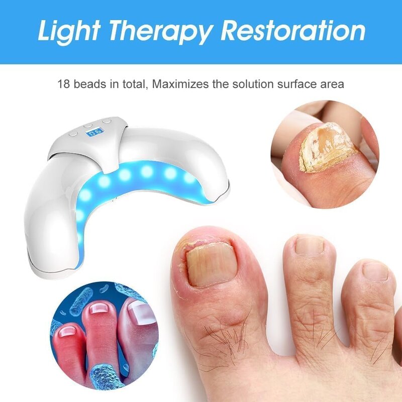 Nail Fungus Lamp - Cost-effective Multifunctional Yellowing Brittle Nails Repair