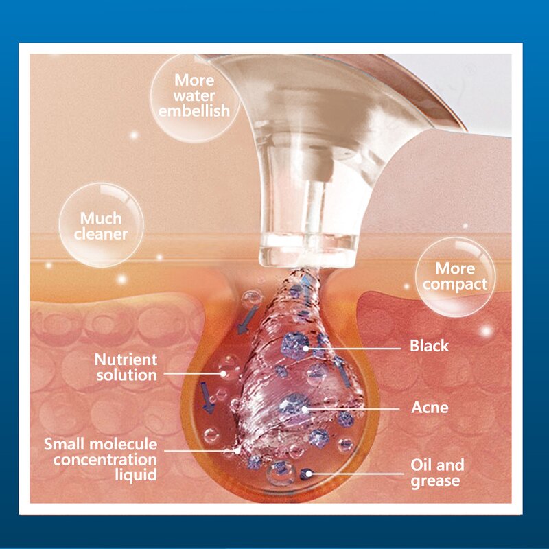 Hydra Dermabrasion Cleaner - 3 Gears Water Oxygen Small Bubble Blue Light Tool