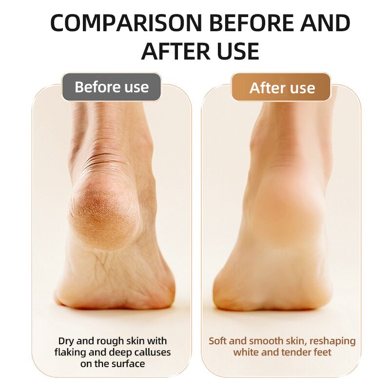 2-in-1 Electric Foot Grinder - 9-speed Rechargeable LED Callus Remover Tool