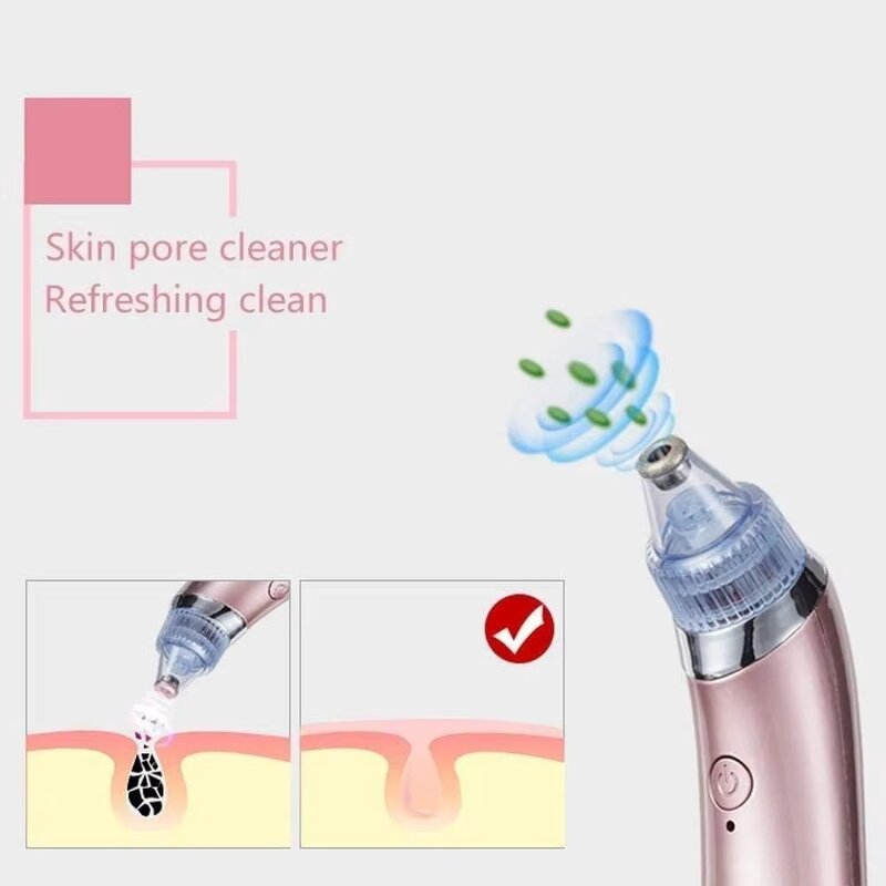 Vacuum Suction Blackhead Remover - Rechargeable Deep Pore Facial Home Salon Tool