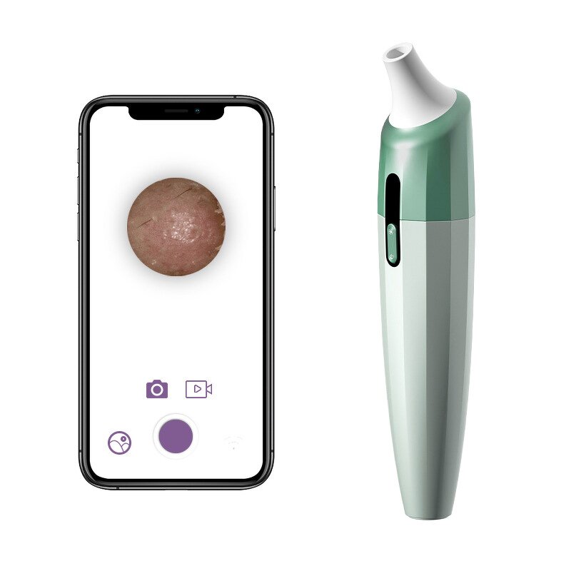 Pore Cleaner Manufacturer - Electric WiFi Visible with HD Camera for Skin Rejuvenation