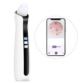 Blackhead Remover Machine Manufacturer - Electric Visible Vacuum with WIFI App