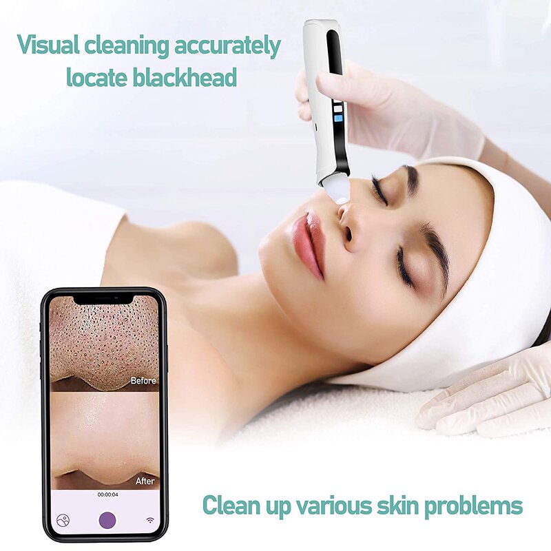 Blackhead Remover Machine Manufacturer - Electric Visible Vacuum with WIFI App