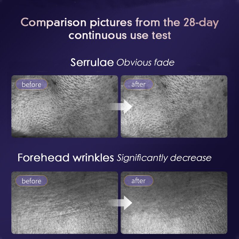 5 in 1 Face Massager - LCD Display EMS Neck Facial Tone Symmetrical Glowing Skin Tool