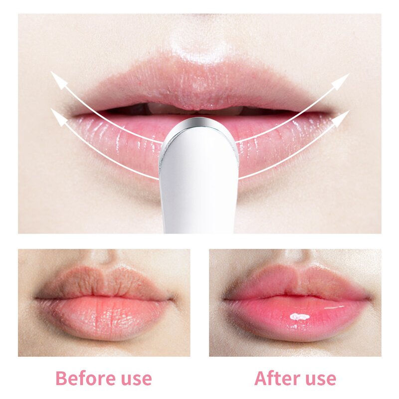 Electric Lip Plumper - 2025 Most Popular Lip Care Balm Set Home Beauty Equipment Tool
