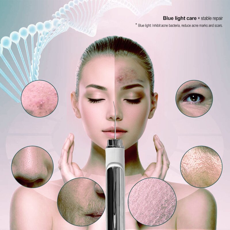 Professional Skin Scrubber Pro - Ultrasonic Blackhead Remover Deep Clean Facial Cleansing