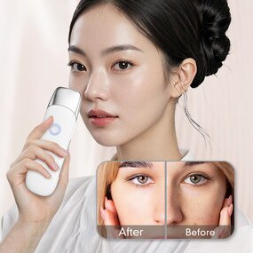 Ultrasonic Ion Massager - Home Use Face Neck Lift Skin Tightening Beauty Booster