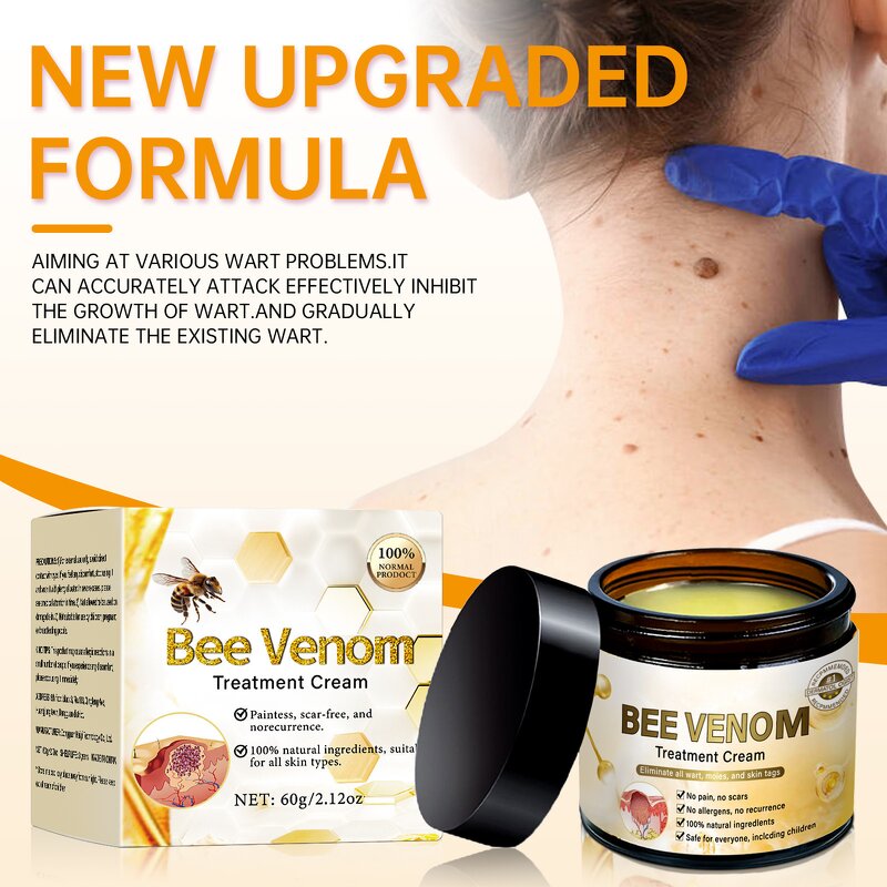 Face Cream Manufacturer - No Logo Bee Venom Treatment for Wart Removing