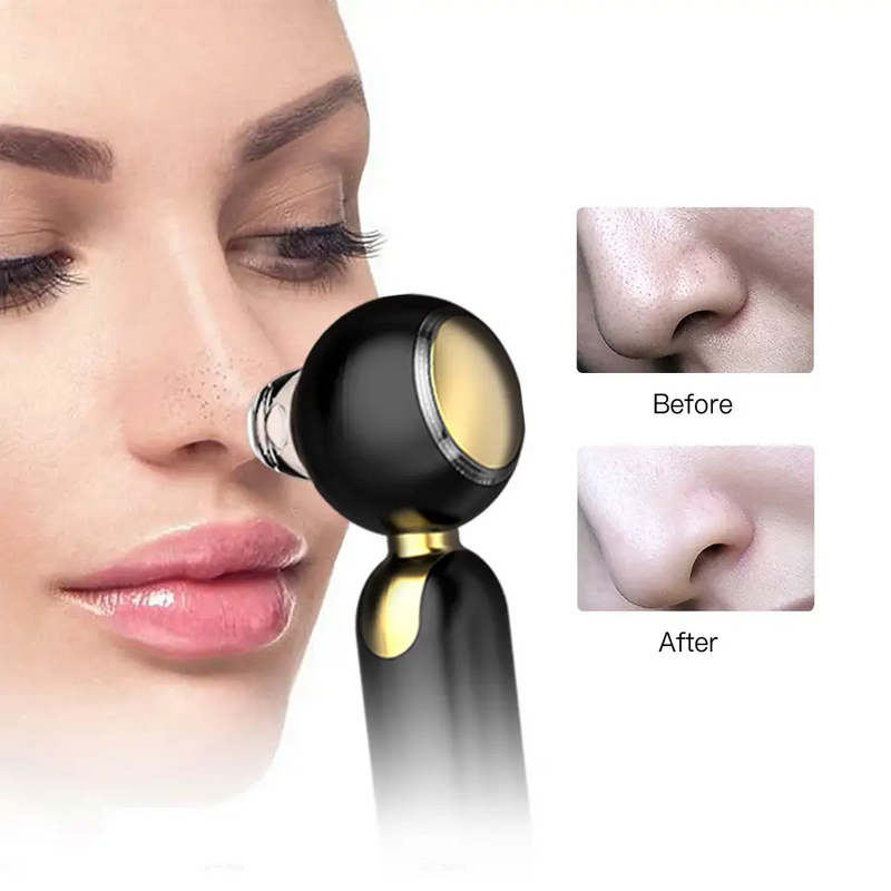Electric Blackhead Remover - Fashion Hot & Cold Vacuum Dark Spot Face Skin Care Tool