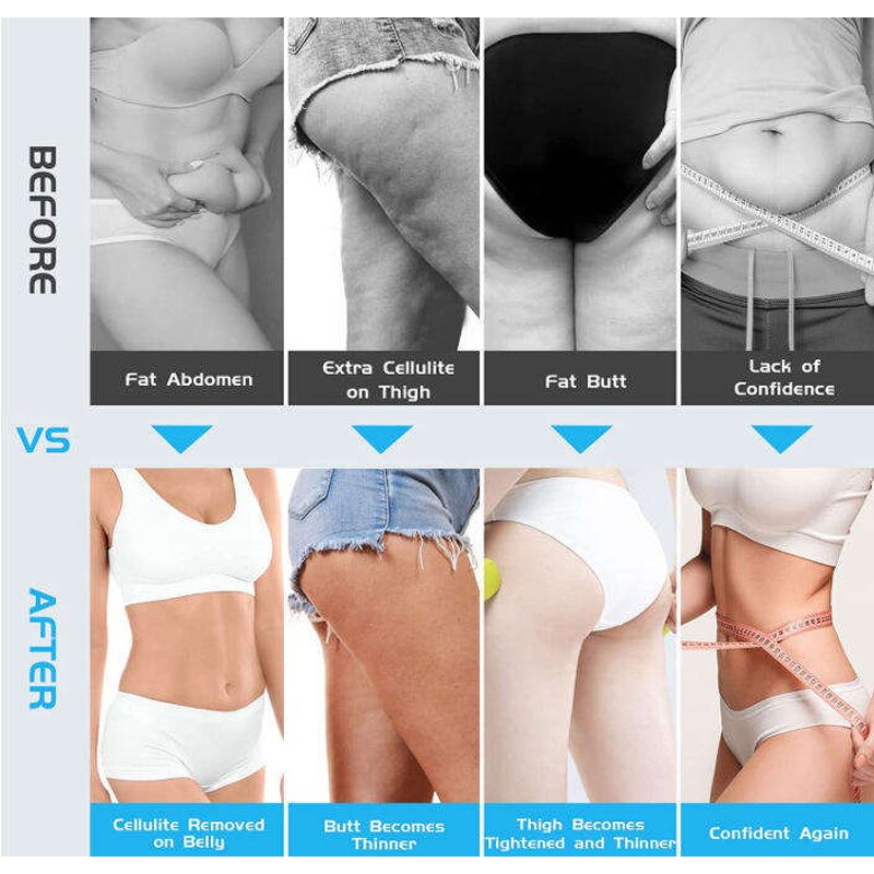 Deep Tissue Body Massager - Electric Cellulite Remover Belly Legs Vibration Sculpt Tool