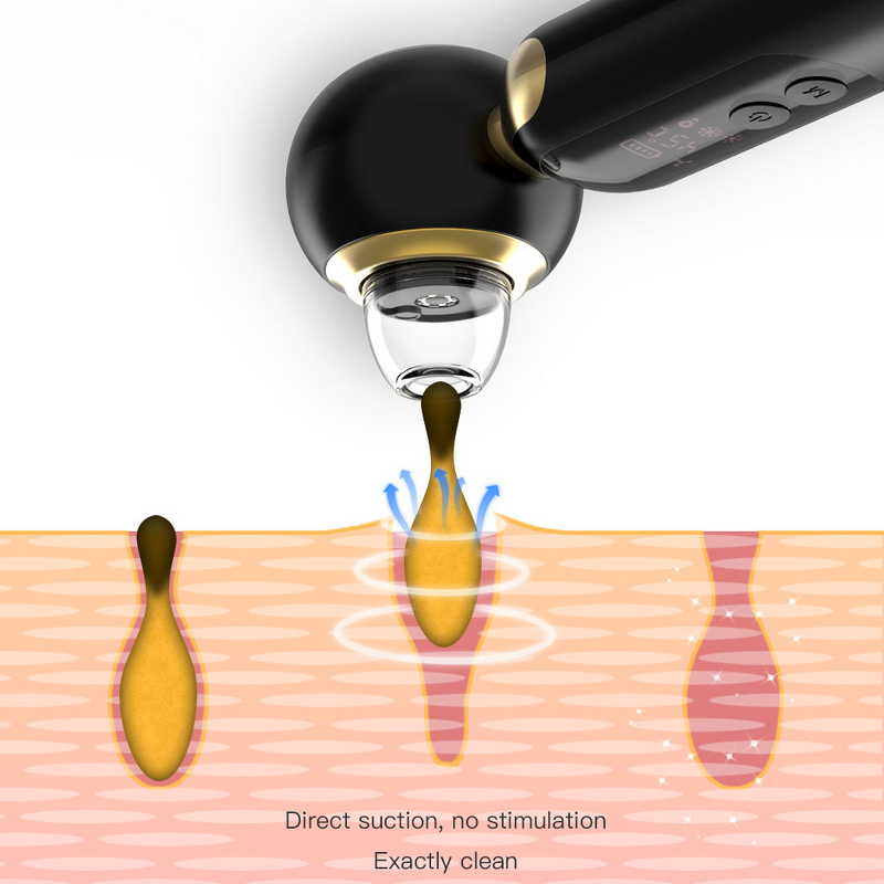 Electric Blackhead Remover - Hot & Cold Vacuum Dark Spot Removal Beauty Women Device