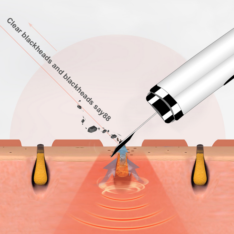 Mini Ultrasonic Scrubber - Best Selling Deep Cleaning Peeling Face Care Beauty Product