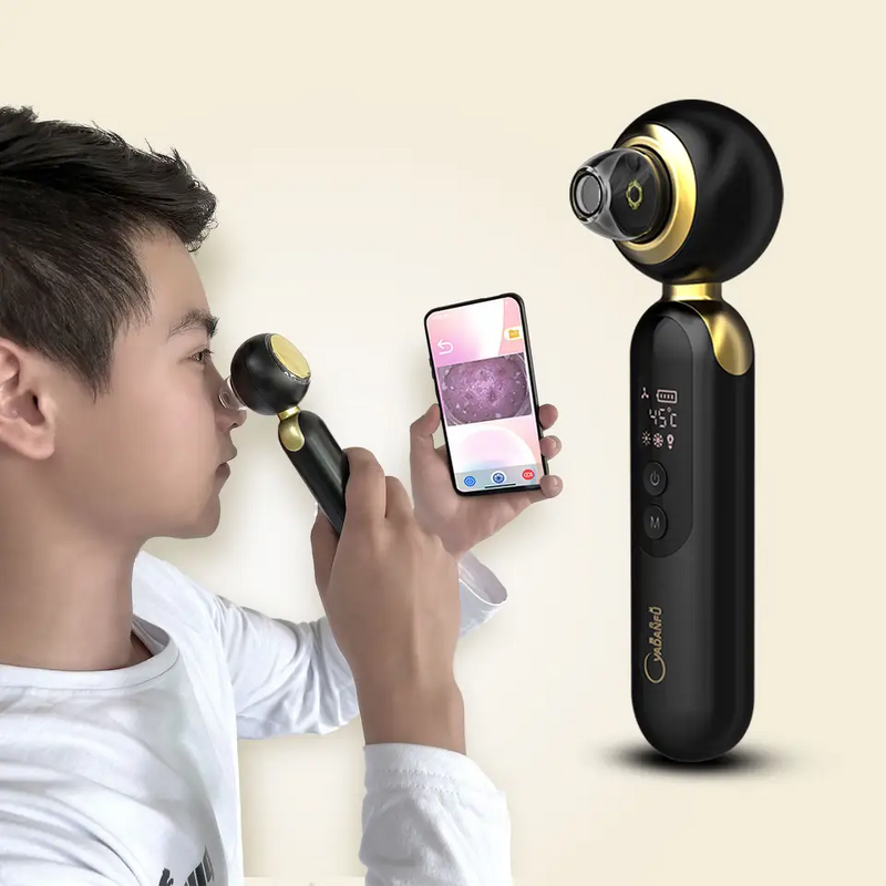 Electric Blackhead Remover - Fashion Hot & Cold Vacuum Dark Spot Face Skin Care Tool