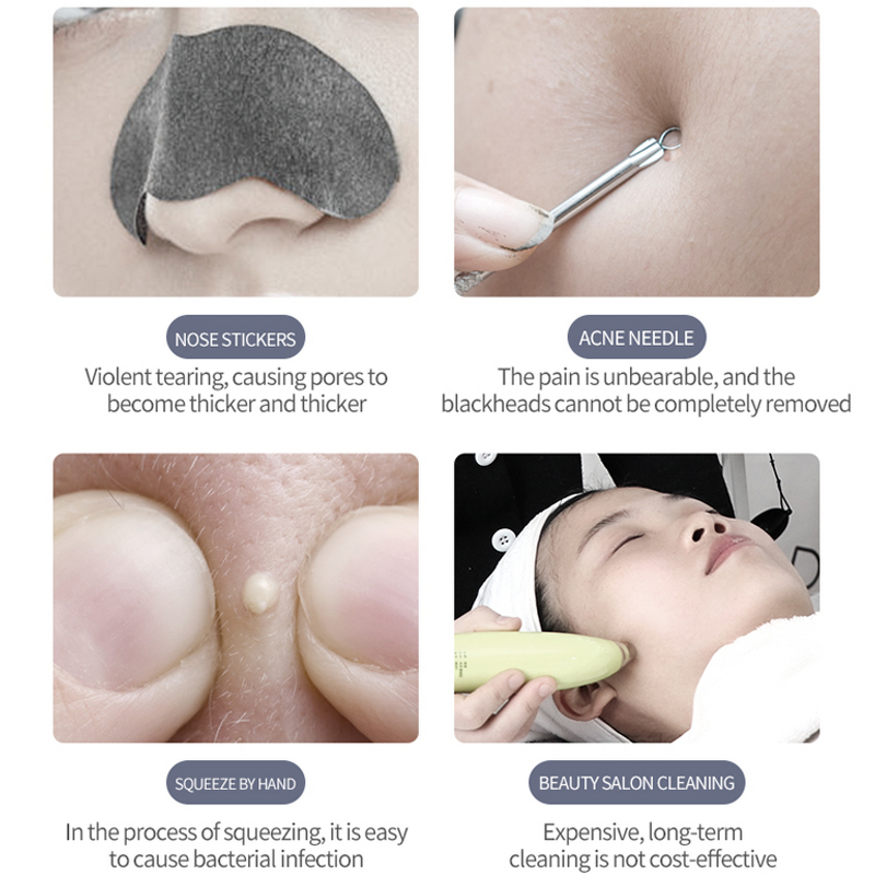 Mini Ultrasonic Scrubber - Home Use Portable Deep Cleaning Peeling Beauty Equipment