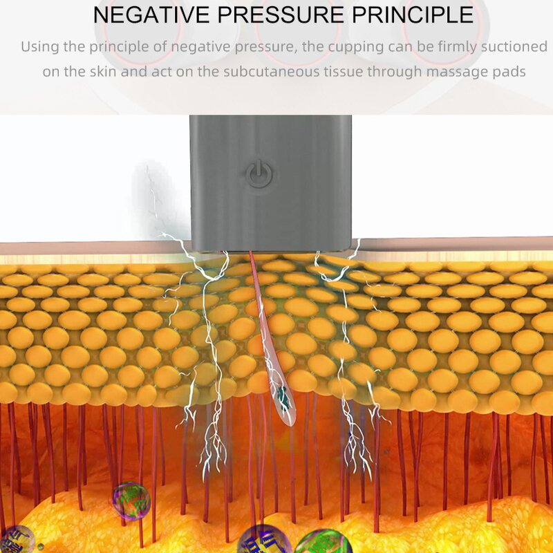 Cupping Massager Manufacturer - Portable New Technology Vacuum Pulse Electric Vibration