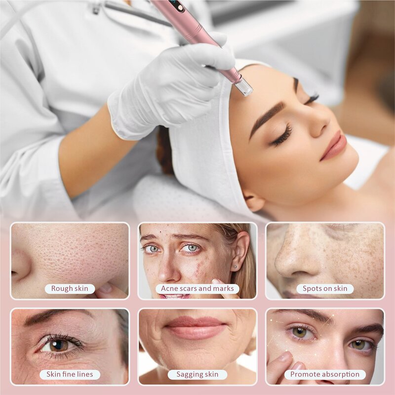 Electric Nano Microneedle - 0-3mm 6 Speed Level Facial Beauty Personal Care Pen