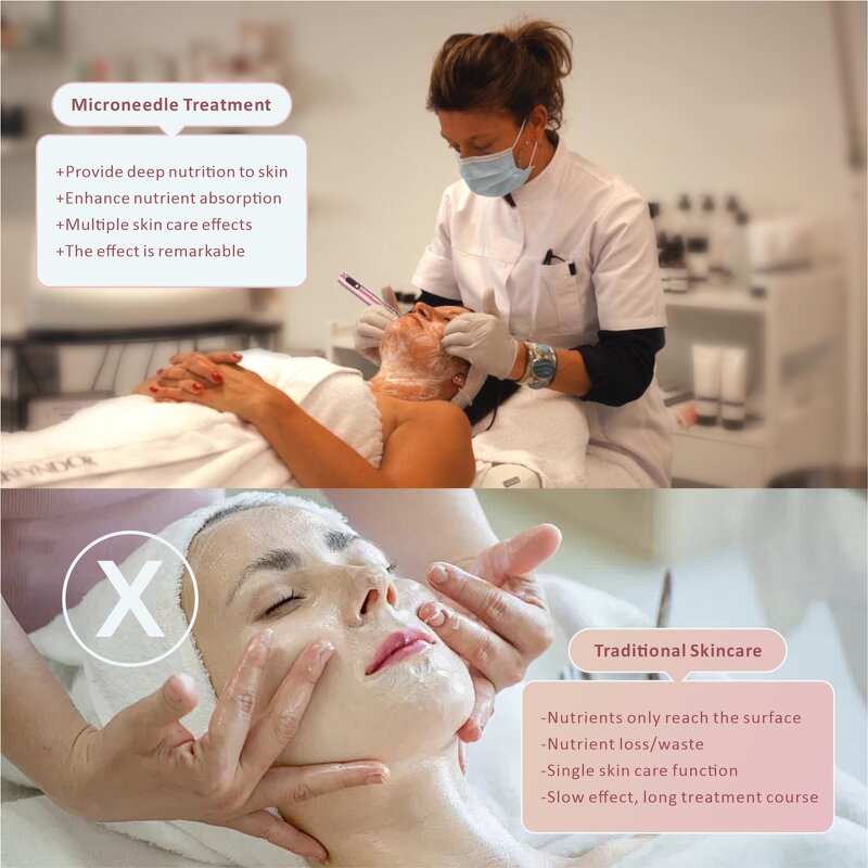 ABS Microneedling Pen - Electric LED Display USB Charge CN & AU Plugs Skin Tightening