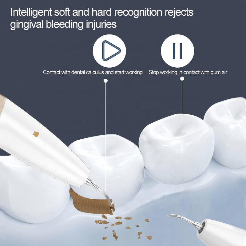 LED Dental Scaler Pen - 3 Modes Ultrasonic Portable Home Teeth Whitening Tool