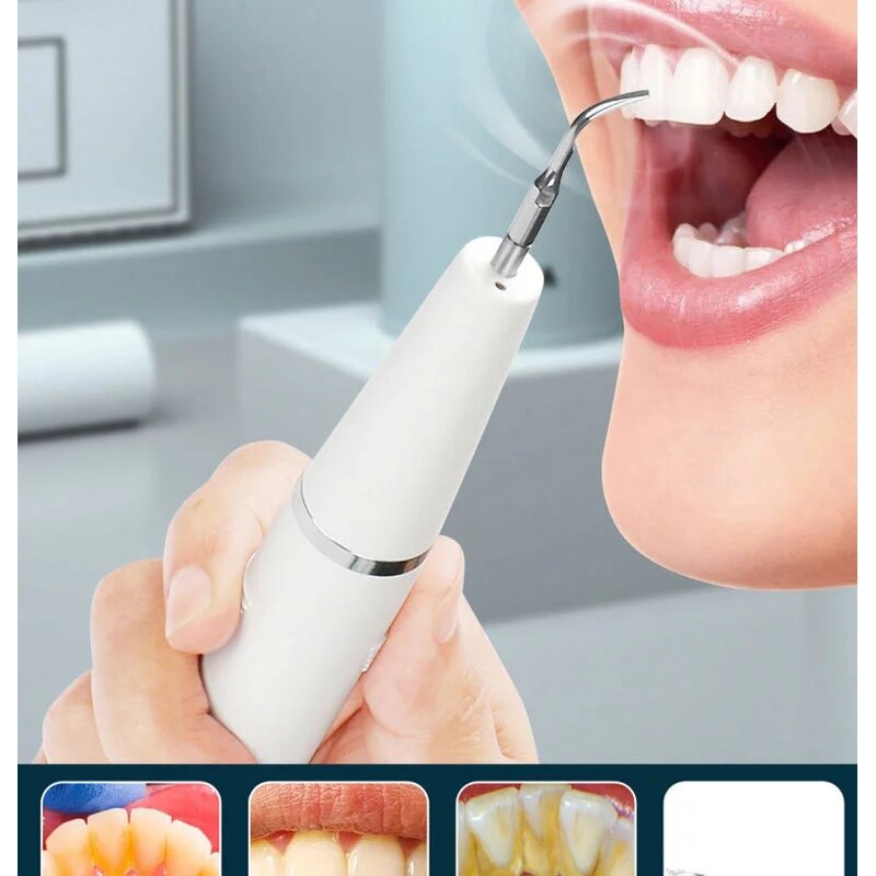 USB Dental Scaler - Health Hygiene Electric Tartar Remove Tooth Cleaner Tool