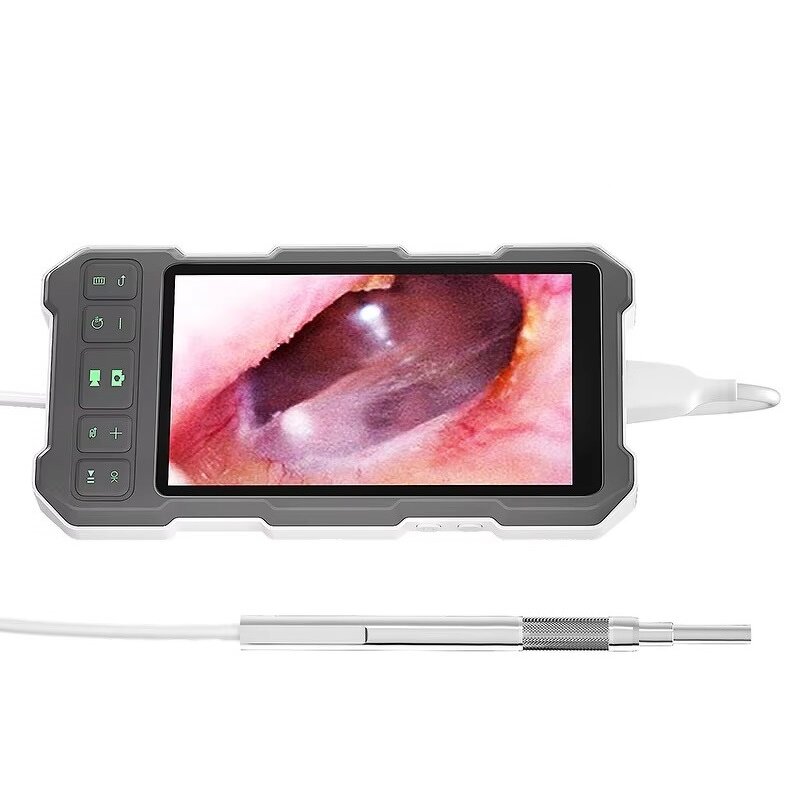 Digital Otoscope - 3.9mm/4.5mm 5inch Screen Ear Wax Removal Visual Clean Tool