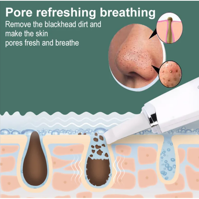 Ultrasonic Facial Massager - Wireless Remote Control Blackhead Pore Removal Face Treatment