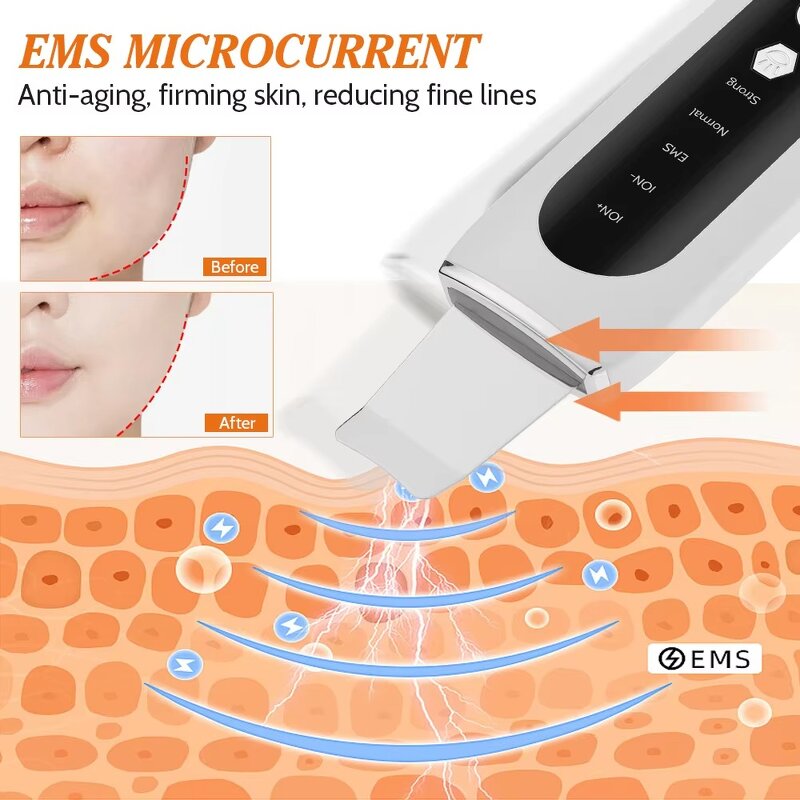Ultrasonic Skin Scrubber - Electric Ion Deep Cleaning Wireless Remote Waterproof Spa