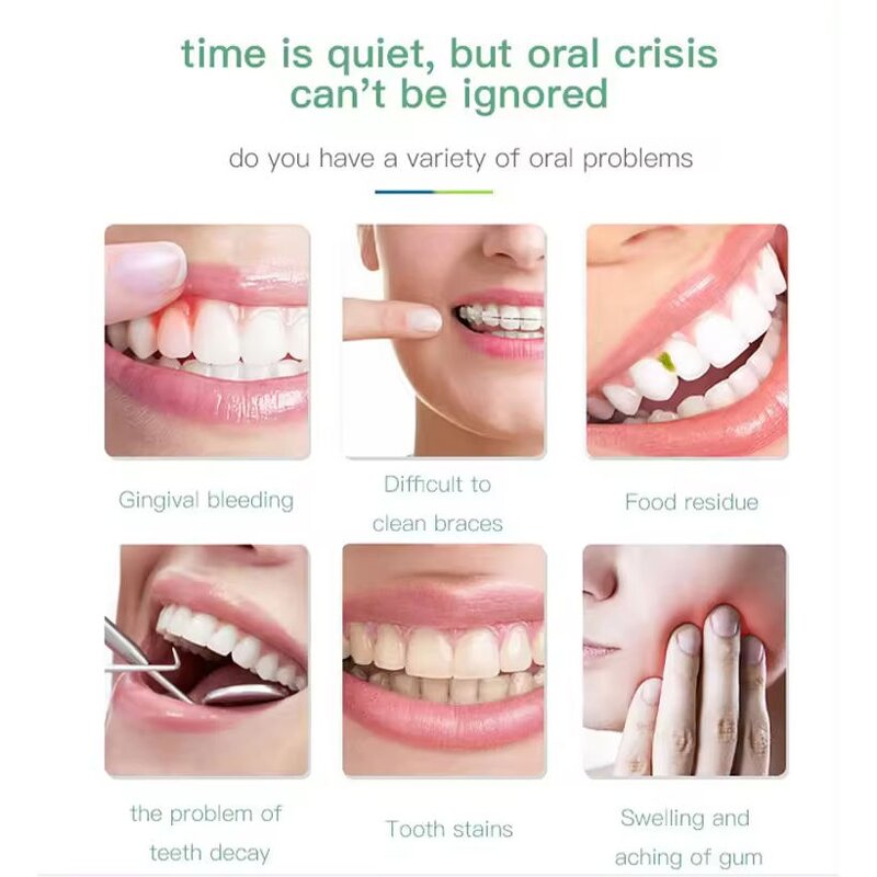 Orthodontic Water Flosser - Portable Household Electric Convenient Oral Irrigator Tool