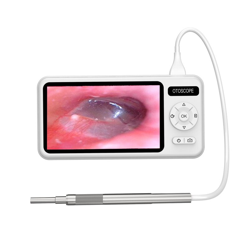 5 Inch Visual Earpick - 1080P IPS 3.9mm 6LED Otoscope Effective Ear Wax Removal