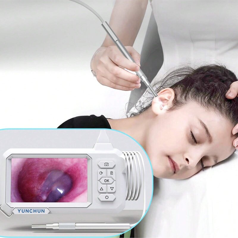 T30 Digital Otoscope - 4.3 Inch 1920x1080 4.9mm Type-C Charging Ear Wax Removal