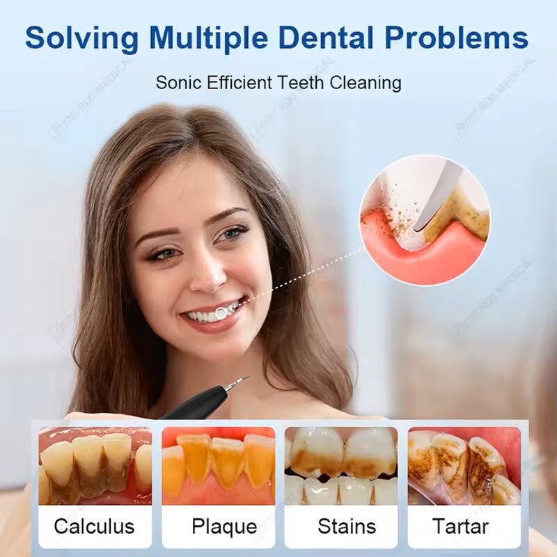 Sonic Toothbrush - High Frequency Household Oral Whitening Tartar Removal Ultrasound