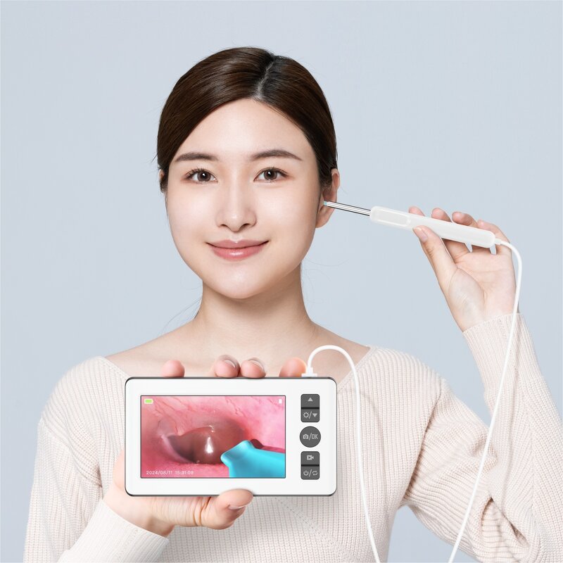 Digital Otoscope - 4.3 Inch Screen 3.5mm Camera Visual Ear Picker Wax Remover Tool