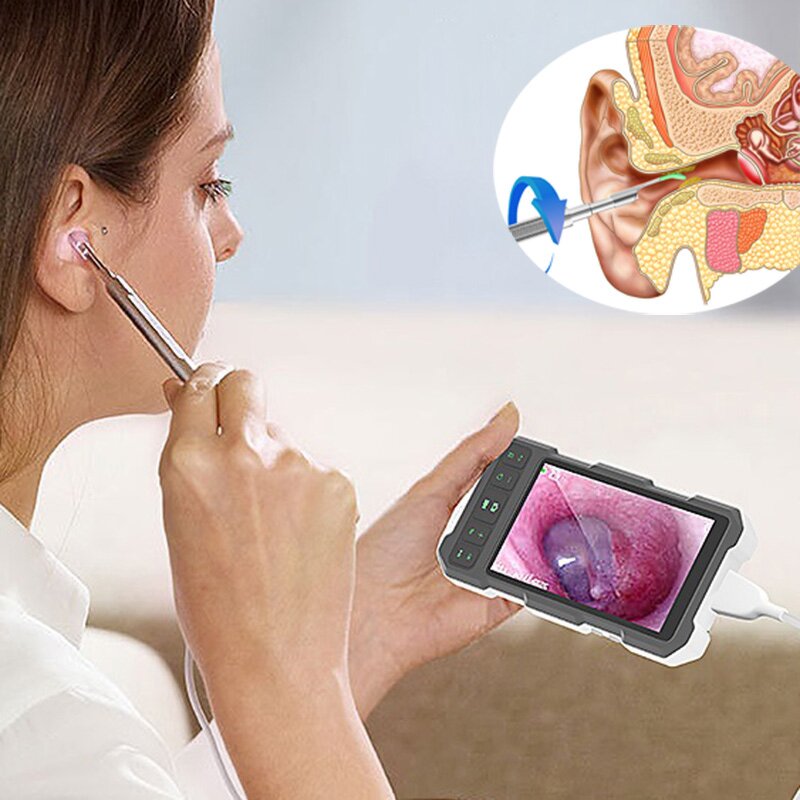 Digital Otoscope - 3.9mm/4.5mm 5inch Screen Ear Wax Removal Visual Clean Tool