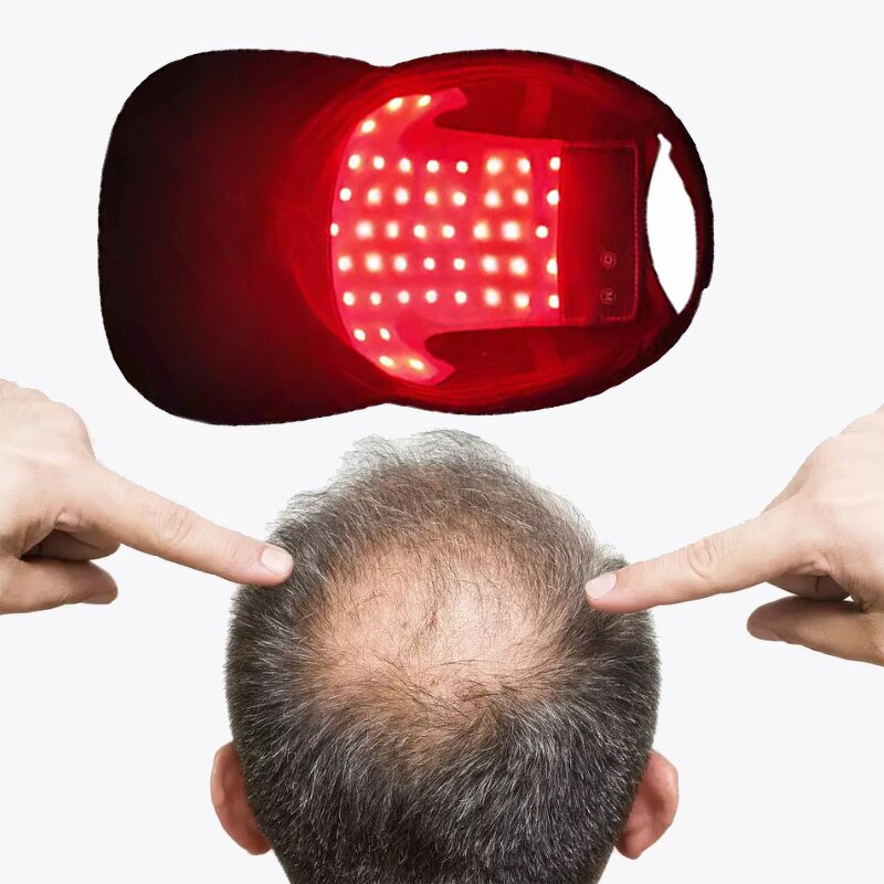 Laser Hair Growth Cap - Wireless Red Light Therapy Professional Hair Loss Treatment Regrowth