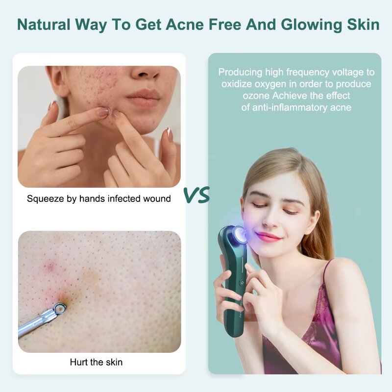 Plasma Facial Device - Ozone Skin Care Acne Scar Removal Whitening Rejuvenation UK/JP