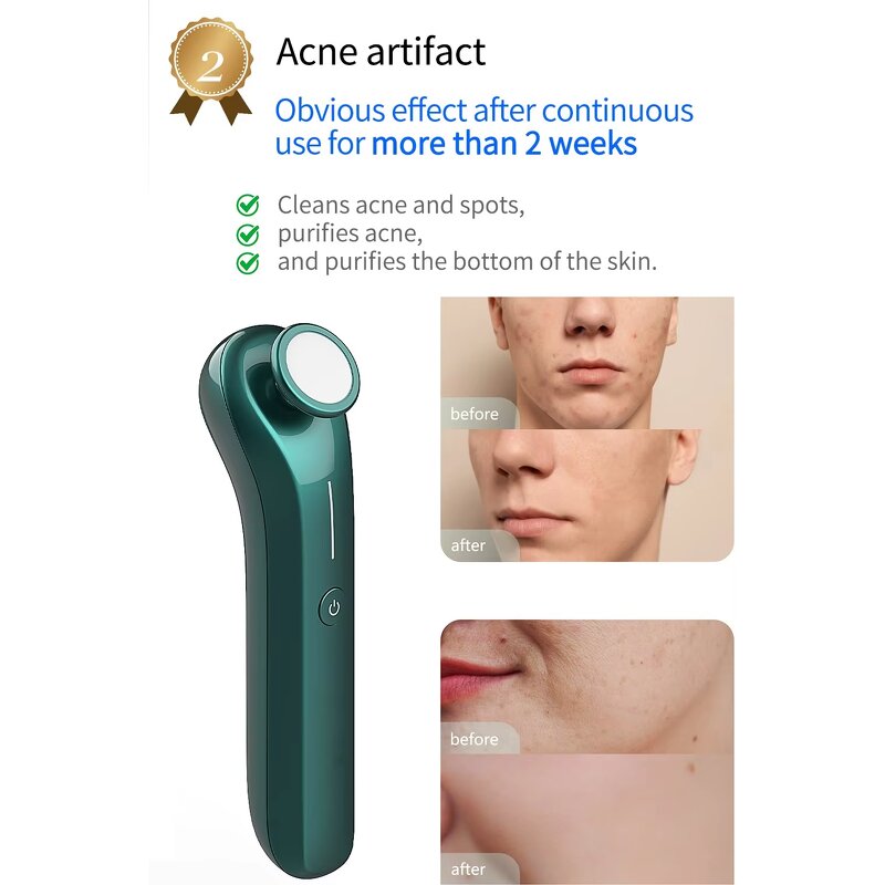 Plasma Facial Device - Ozone Skin Care Acne Scar Removal Whitening Rejuvenation UK/JP