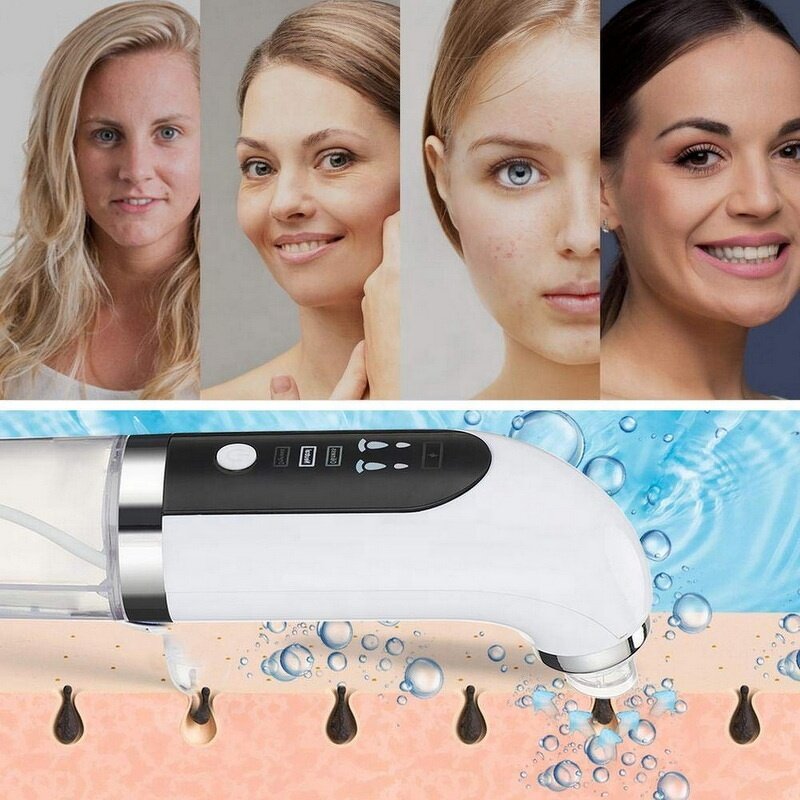 Small Bubble Blackhead Remover - Strong Vacuum - Suction Pore Pimple Removal Beauty Tool