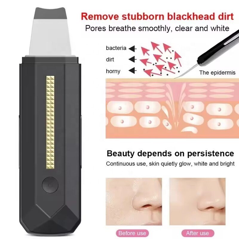 Ultrasonic Skin Scrubber - 2024 Handheld - Waterproof Face Peeling Blackhead Remover